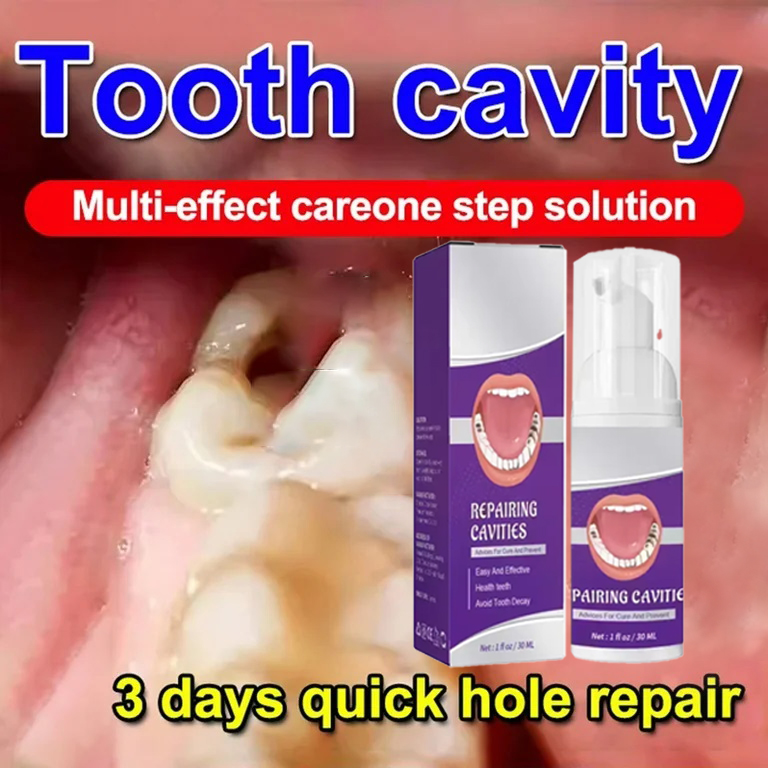 Teeth Whitening Toothpaste - ทําความสะอาดฟันยาสีฟันขจัดคราบฟันฟันไวท์เทนนิ่งฟันผุซ่อมแคลคูลัสแผ่นโรคปริทันต์อักเสบลบฟันผุ
