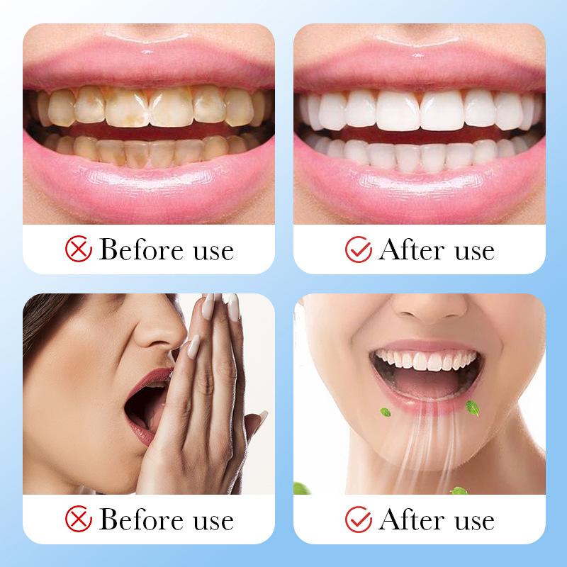 ถ่านไม้ไผ่ ถ่านกัมมันต์ ผงฟอกส - Whitening Powder Activated บทวิจารณ์และราคา