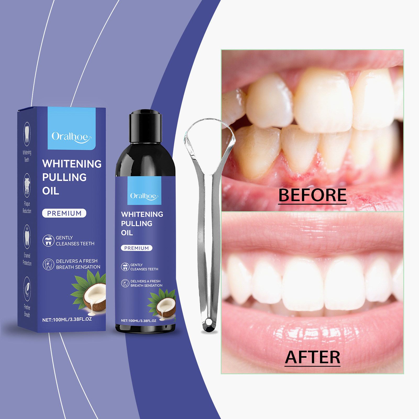 น้ำยาบ้วนปากสูตรน้ำมันมะพร้าวผ - Teeth Whitening With Coconut Oil บทวิจารณ์และราคา