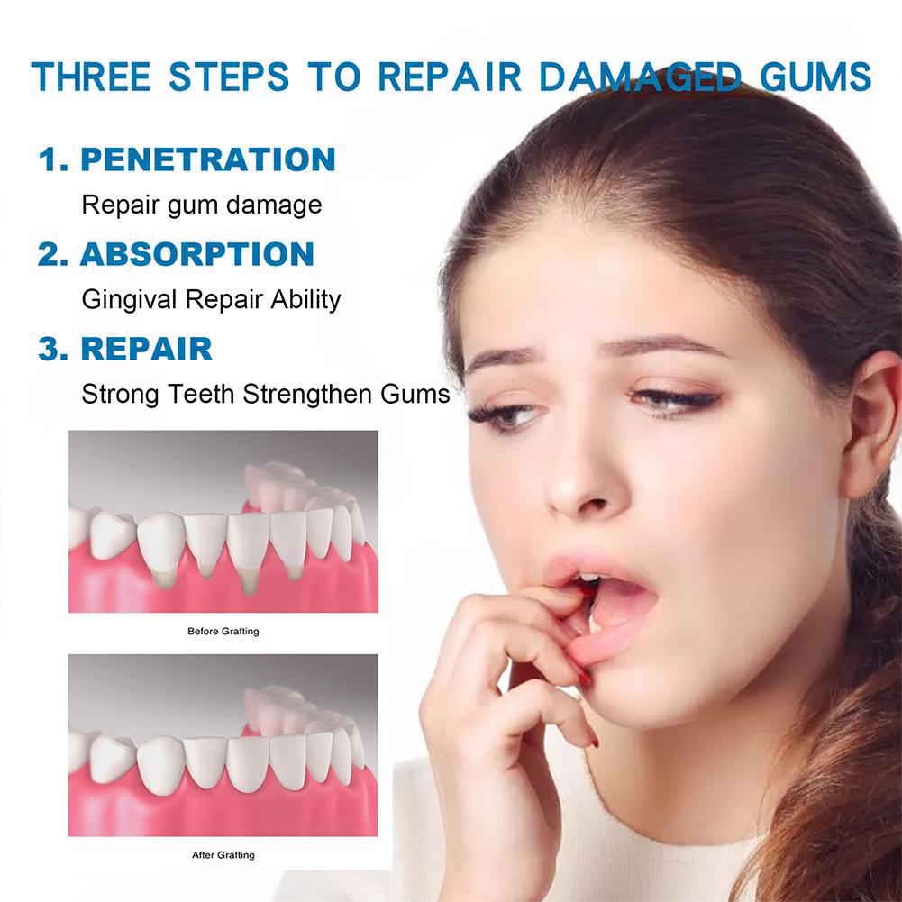 ยาสีฟันดูแลสุขภาพช่องปาก ยาสีฟ - Teeth Whitening Naturally บทวิจารณ์และราคา