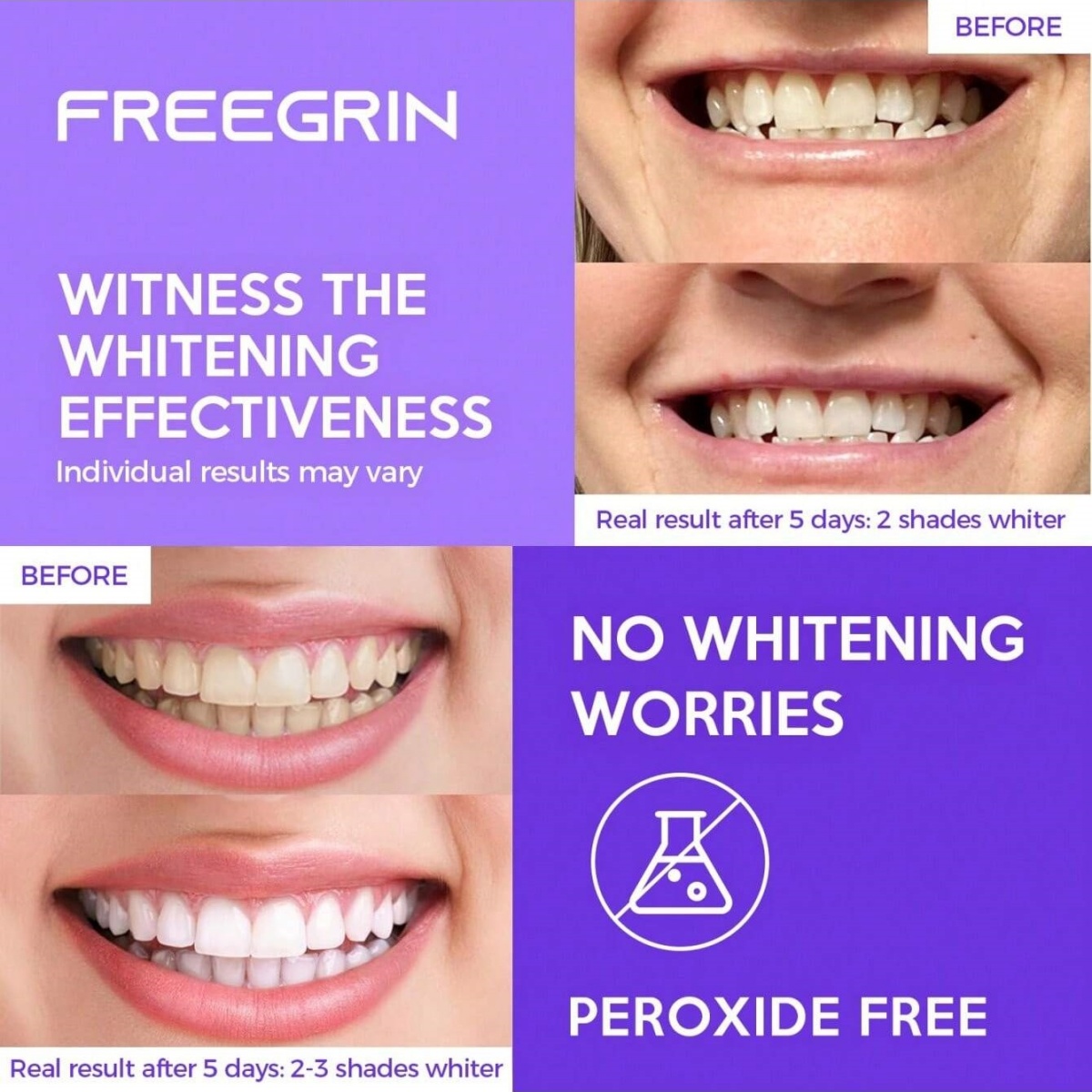ดีลักซ์สติกเกอร์ฟอกสีฟัน 7/14/ - Teeth Whitening Ulta บทวิจารณ์และราคา
