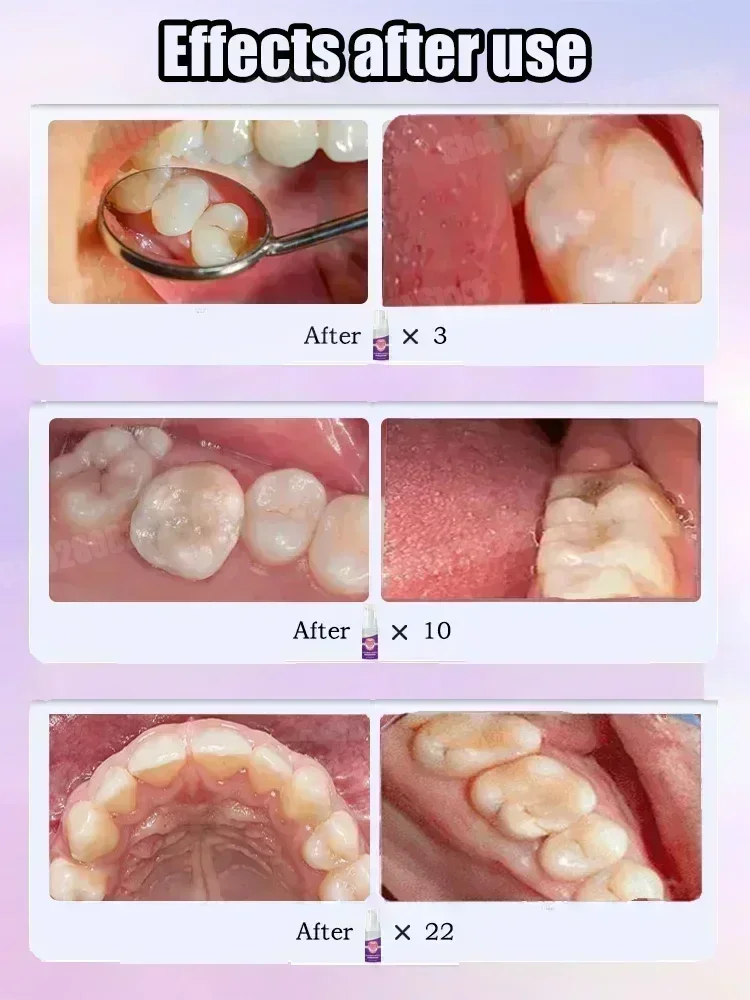 ทําความสะอาดฟันยาสีฟันขจัดคราบ - Teeth Whitening Toothpaste บทวิจารณ์และราคา