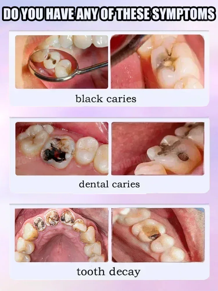 ทําความสะอาดฟันยาสีฟันขจัดคราบ - Teeth Whitening Toothpaste บทวิจารณ์และราคา